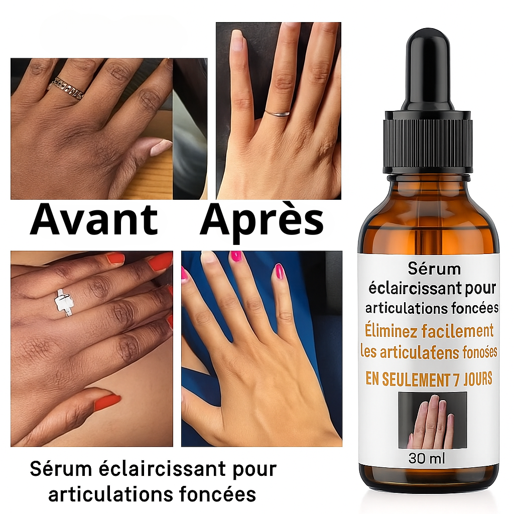 Huile Essentielle Éclaircissante – Articulations & Zones Sombres (30ml)