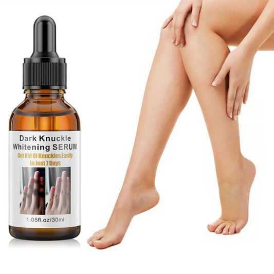 Huile Essentielle Éclaircissante – Articulations & Zones Sombres (30ml)