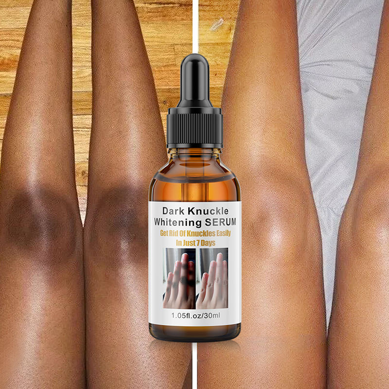 Huile Essentielle Éclaircissante – Articulations & Zones Sombres (30ml)